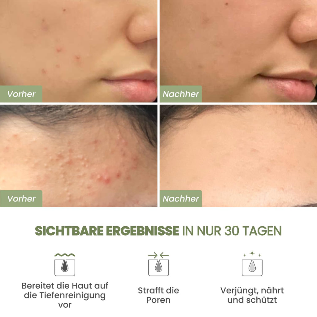 PLANTIFIQUE Koreanische Gesichtsmaske Mit Avocado, Fango & Superfoods 110G - Tonerde Maske Körper Und Gesicht anti Pickel Poren Mitesserentferner - Korean Clay Face & Body Mask