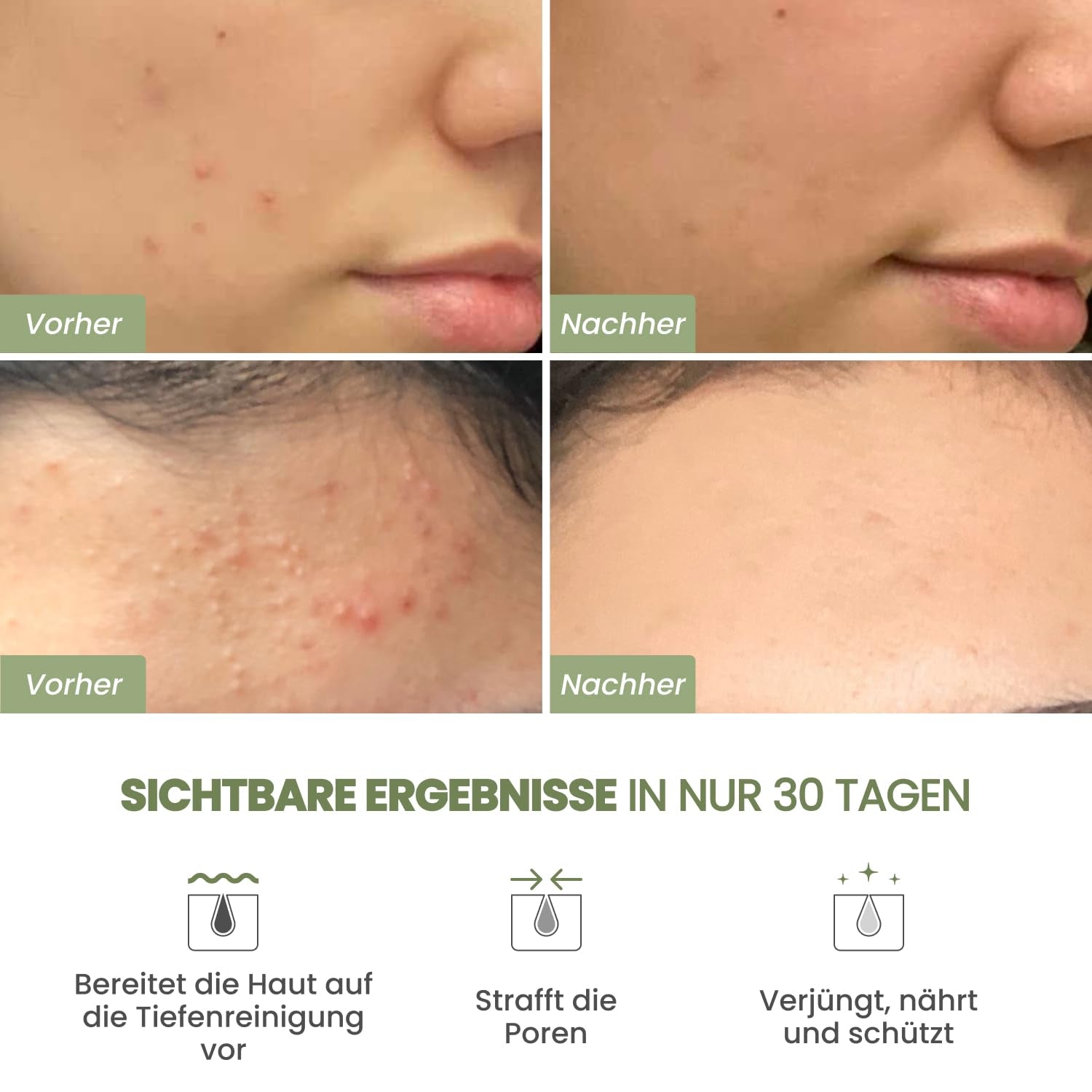 PLANTIFIQUE Koreanische Gesichtsmaske Mit Avocado, Fango & Superfoods 110G - Tonerde Maske Körper Und Gesicht anti Pickel Poren Mitesserentferner - Korean Clay Face & Body Mask