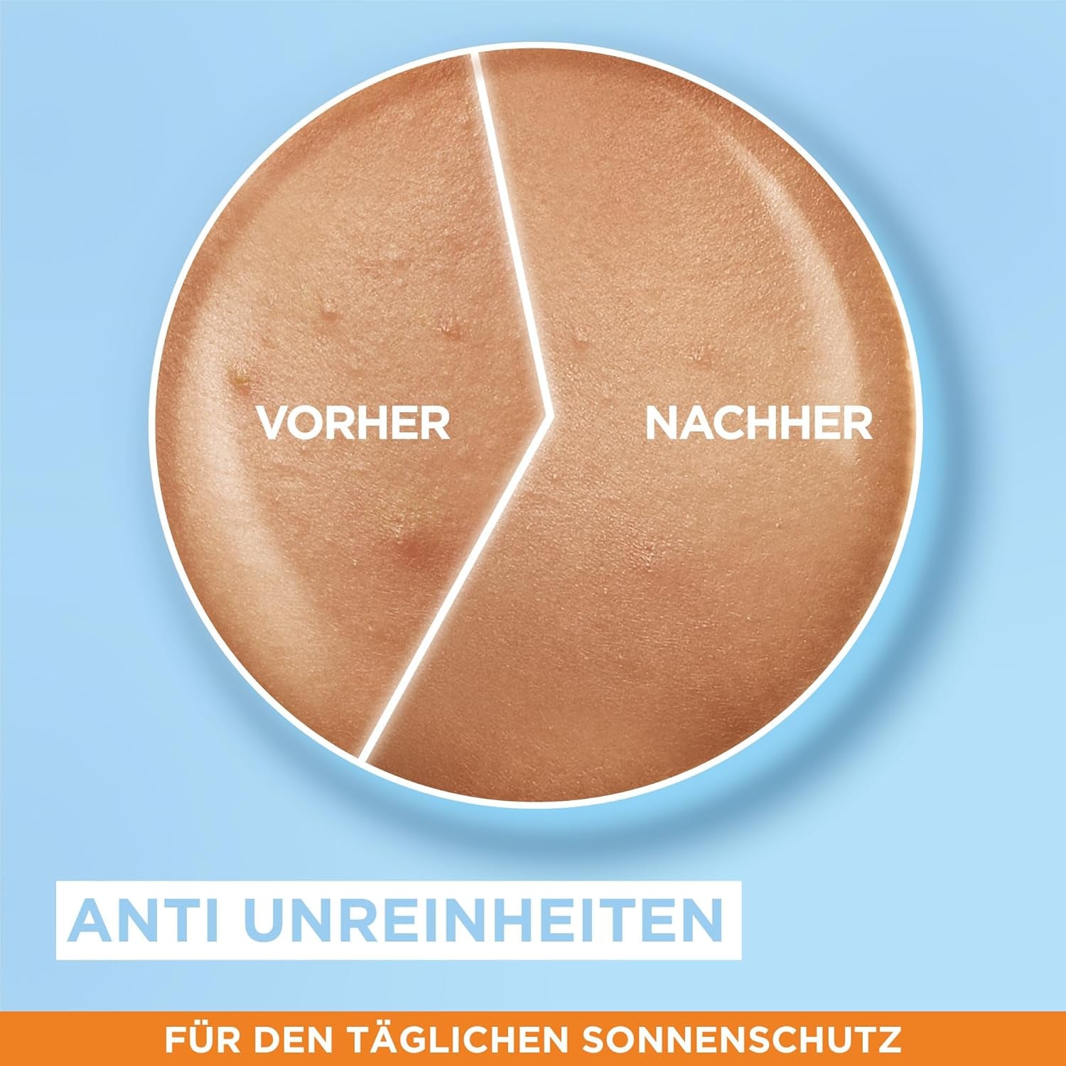 Garnier Ambre Solaire LSF 50+ Super UV Fluid Sonnenschutz, Sonnencreme Mit Hyaluronsäure, Ultraleichte & Mattierende Formel Für Das Gesicht, Unsichtbar, Schutz Vor Sonnenbrand & Pigmentflecken, 40Ml
