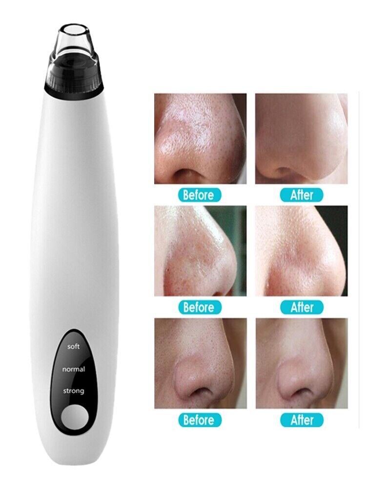 (US Shipping) Electric Blackhead Remover Cleaner Face Diamond Pore Vacuum Suction White Heads