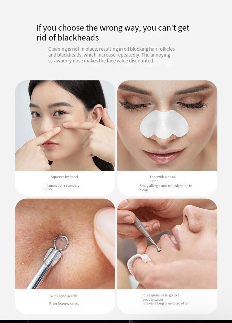 (US Shipping) Electric Blackhead Remover Cleaner Face Diamond Pore Vacuum Suction White Heads