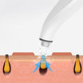 (US Shipping) Electric Blackhead Remover Cleaner Face Diamond Pore Vacuum Suction White Heads